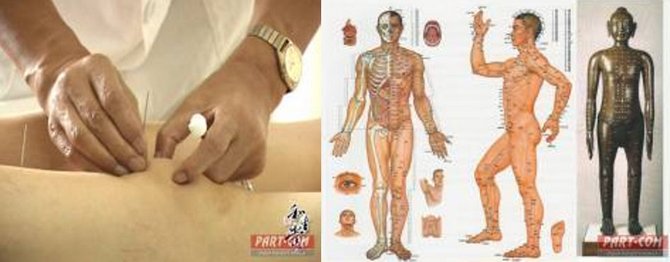 Лечебно-диагностический метод Гуа Ша