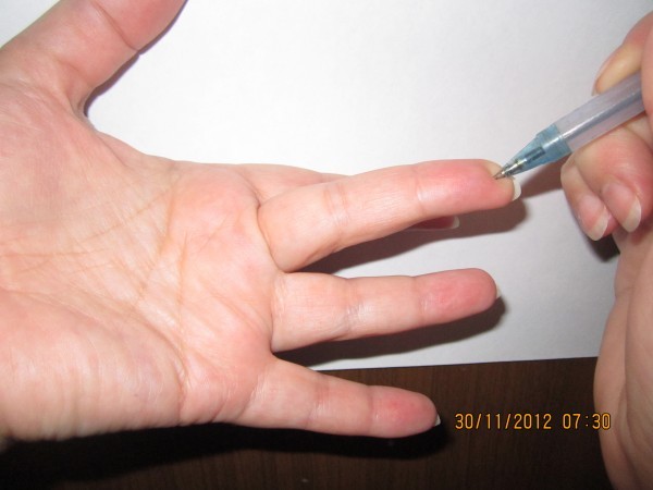 Особая точка на пальце